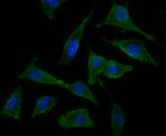 NRCAM Antibody in Immunocytochemistry (ICC/IF)