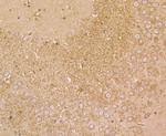 NRCAM Antibody in Immunohistochemistry (Paraffin) (IHC (P))