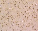 NRCAM Antibody in Immunohistochemistry (Paraffin) (IHC (P))