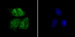 RAD21 Antibody in Immunocytochemistry (ICC/IF)