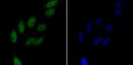 RAD21 Antibody in Immunocytochemistry (ICC/IF)