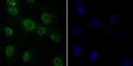 RAD21 Antibody in Immunocytochemistry (ICC/IF)