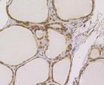 RAD21 Antibody in Immunohistochemistry (Paraffin) (IHC (P))