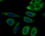 Perforin Antibody in Immunocytochemistry (ICC/IF)