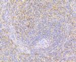 Perforin Antibody in Immunohistochemistry (Paraffin) (IHC (P))