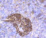 CD99 Antibody in Immunohistochemistry (Paraffin) (IHC (P))