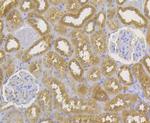 CD99 Antibody in Immunohistochemistry (Paraffin) (IHC (P))