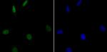 GPR30 Antibody in Immunocytochemistry (ICC/IF)