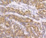 GPR30 Antibody in Immunohistochemistry (Paraffin) (IHC (P))