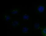 MICA/B Antibody in Immunocytochemistry (ICC/IF)