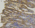 MICA/B Antibody in Immunohistochemistry (Paraffin) (IHC (P))