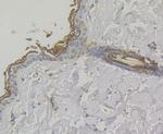 MICA/B Antibody in Immunohistochemistry (Paraffin) (IHC (P))