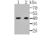 MICA/B Antibody in Western Blot (WB)