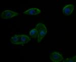 Kir6.2 (KCNJ11) Antibody in Immunocytochemistry (ICC/IF)