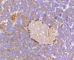 Kir6.2 (KCNJ11) Antibody in Immunohistochemistry (Paraffin) (IHC (P))