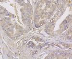 Kir6.2 (KCNJ11) Antibody in Immunohistochemistry (Paraffin) (IHC (P))