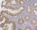 CDH17 Antibody in Immunohistochemistry (Paraffin) (IHC (P))