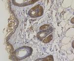 Cytokeratin 5 Antibody in Immunohistochemistry (Paraffin) (IHC (P))