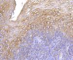 Cytokeratin 5 Antibody in Immunohistochemistry (Paraffin) (IHC (P))