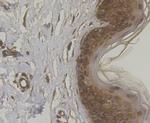 Cytokeratin 5 Antibody in Immunohistochemistry (Paraffin) (IHC (P))