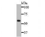 Cytokeratin 5 Antibody in Western Blot (WB)