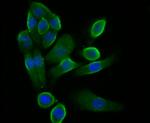 STIM2 Antibody in Immunocytochemistry (ICC/IF)