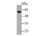 Cytokeratin 14 Antibody in Western Blot (WB)