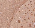 B3GAT1 Antibody in Immunohistochemistry (Paraffin) (IHC (P))