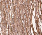 Myoglobin Antibody in Immunohistochemistry (Paraffin) (IHC (P))