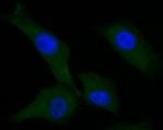 AKT3 Antibody in Immunocytochemistry (ICC/IF)