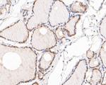 AKT3 Antibody in Immunohistochemistry (Paraffin) (IHC (P))