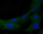 TMX Antibody in Immunocytochemistry (ICC/IF)