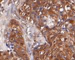 TMX Antibody in Immunohistochemistry (Paraffin) (IHC (P))