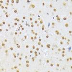 A1CF Antibody in Immunohistochemistry (Paraffin) (IHC (P))