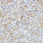 ABI1 Antibody in Immunohistochemistry (Paraffin) (IHC (P))