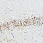 ABI1 Antibody in Immunohistochemistry (Paraffin) (IHC (P))