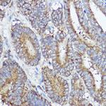 ABI1 Antibody in Immunohistochemistry (Paraffin) (IHC (P))