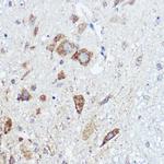 ABI1 Antibody in Immunohistochemistry (Paraffin) (IHC (P))