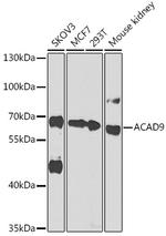 ACAD9 Antibody in Western Blot (WB)