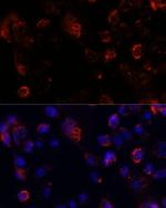 ACOT9 Antibody in Immunocytochemistry (ICC/IF)