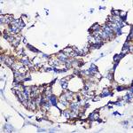 ACSS1 Antibody in Immunohistochemistry (Paraffin) (IHC (P))