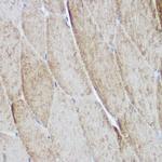 alpha Actinin 3 Antibody in Immunohistochemistry (Paraffin) (IHC (P))