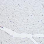 alpha Actinin 3 Antibody in Immunohistochemistry (Paraffin) (IHC (P))