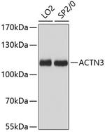 alpha Actinin 3 Antibody in Western Blot (WB)