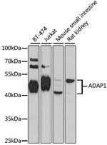 Centaurin alpha-1 Antibody in Western Blot (WB)