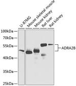 ADRA2B Antibody in Western Blot (WB)