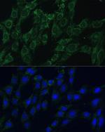 AEBP1 Antibody in Immunocytochemistry (ICC/IF)