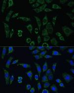 AEBP1 Antibody in Immunocytochemistry (ICC/IF)