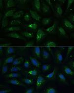 AEBP1 Antibody in Immunocytochemistry (ICC/IF)