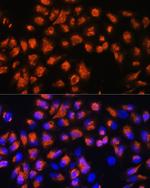 Agrin Antibody in Immunocytochemistry (ICC/IF)